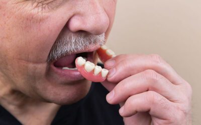 What are Permanent Dentures?