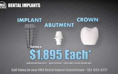 How Much Do Dental Implants Cost?